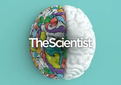 Using Brain Organoids in Human Health and Disease Research